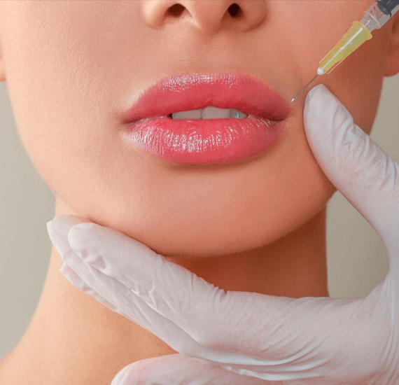 Lippenfüller