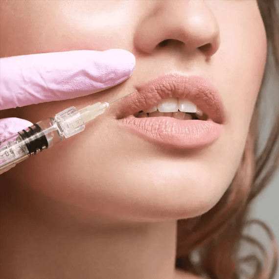 Lippenfüller