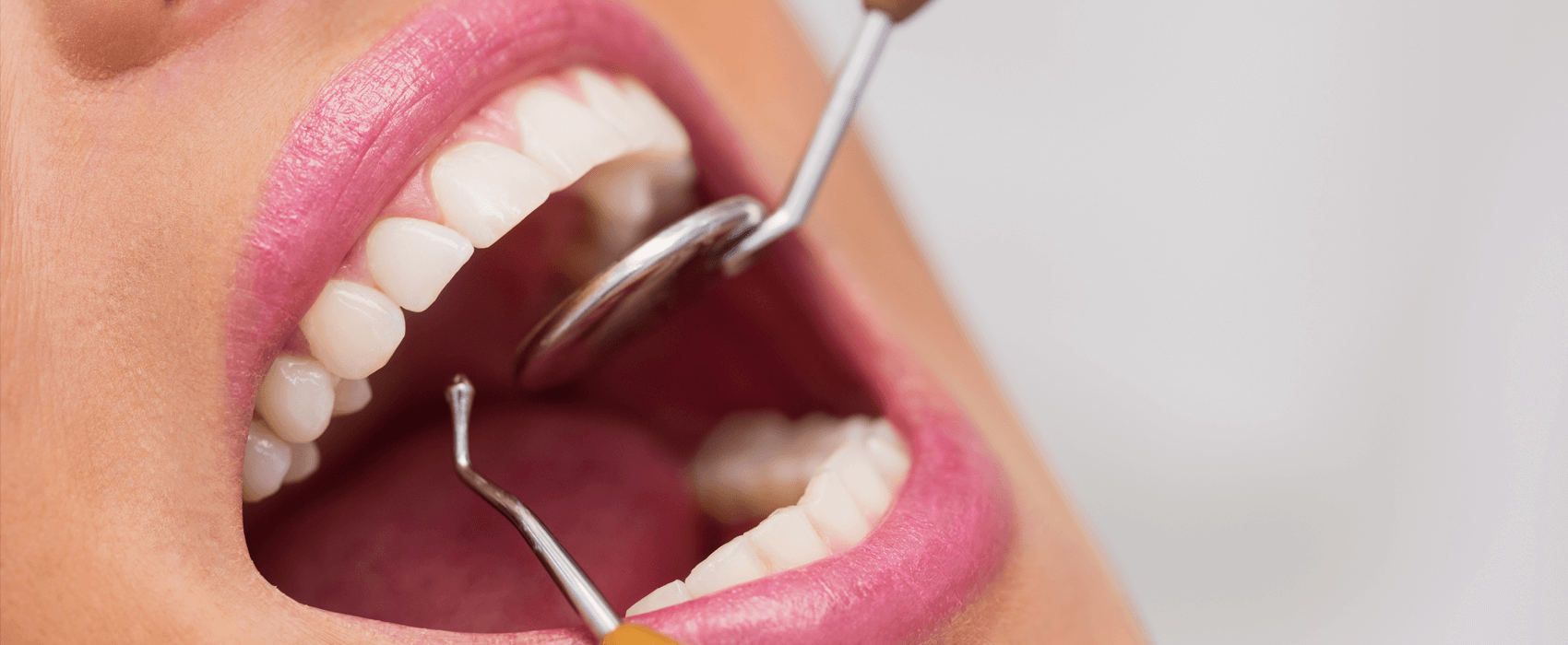 Wurzelkanalbehandlung